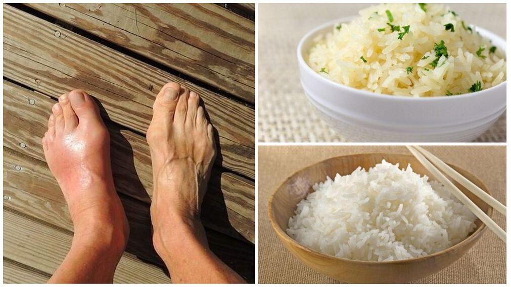 Pacientom s dnou sa odporúča diéta na báze ryže. 